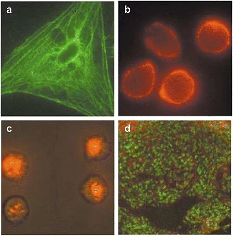 Application of functional quantum dot nanoparticles as fluorescence probes in cell labeling and tumor diagnostic imaging
