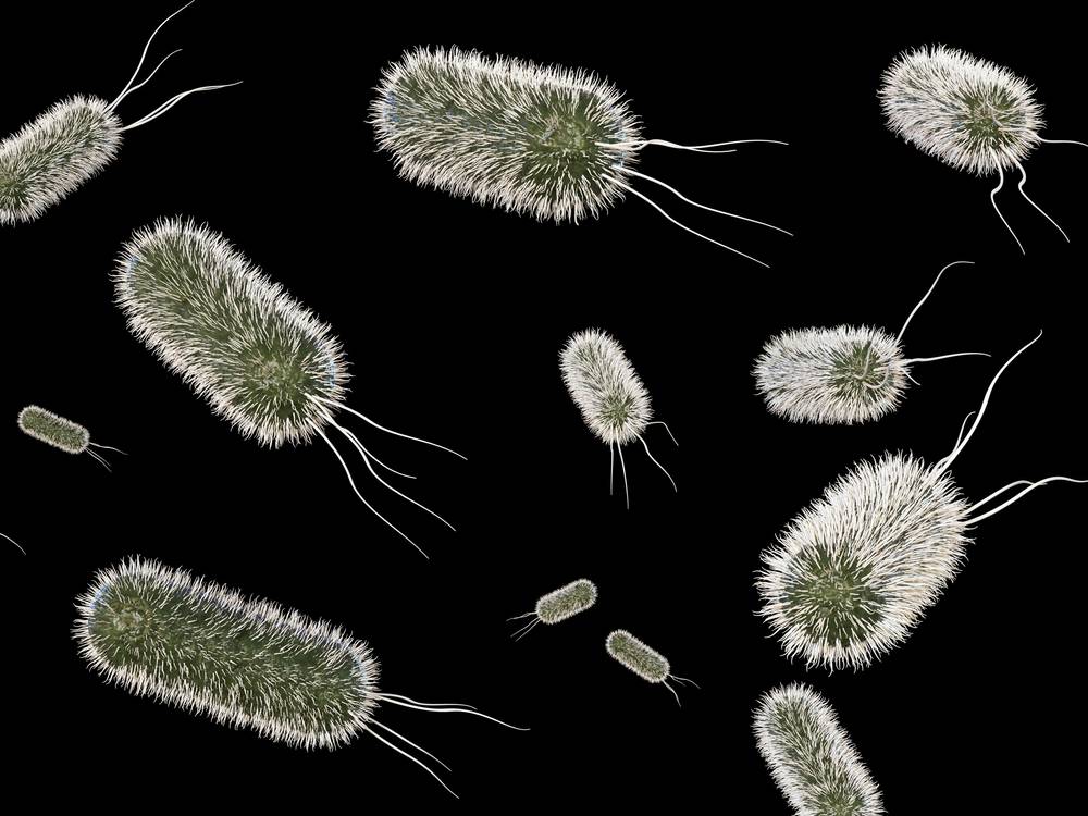 Escherichia coli protein expression