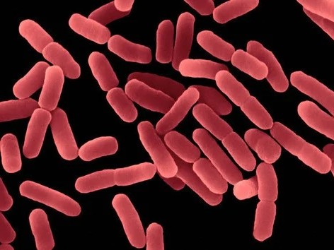 Bacillus subtilis expression system