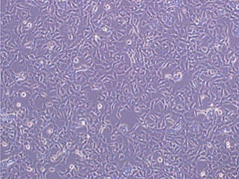 Transient mammalian expression (HEK293 and CHO)