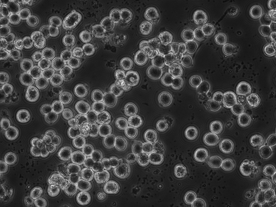 Protein co-expression in insect cells