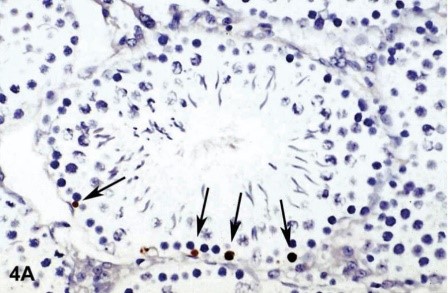 Apoptosis Assays