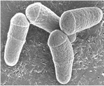 Corynebacterium glutamicum Expression Systems